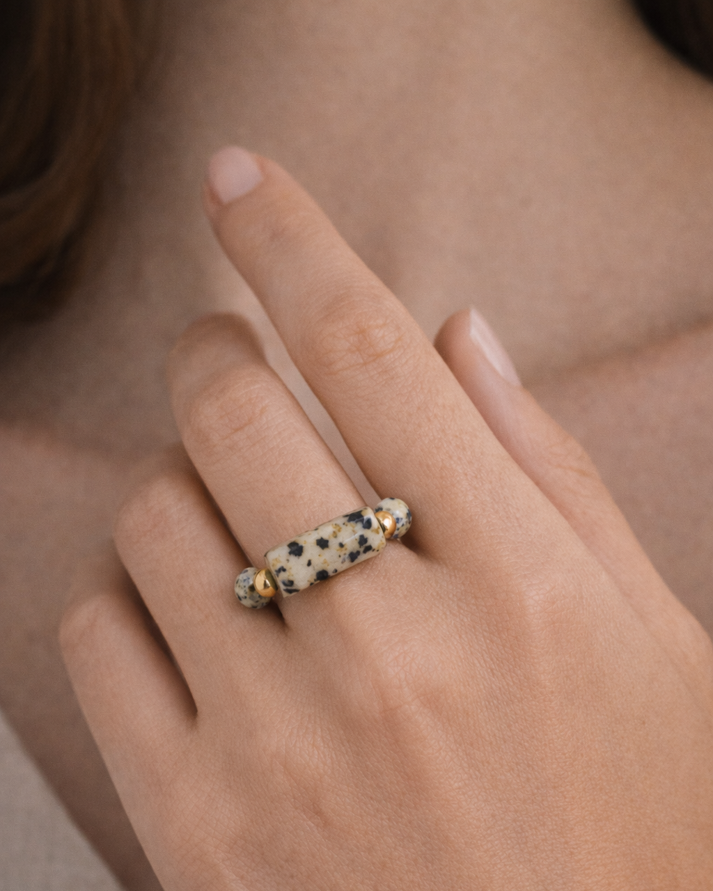 Dalmatian Ring